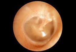 The middle ear.